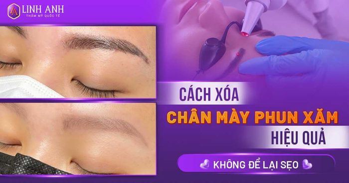 Thẩm Mỹ Quốc Tế Linh Anh - Bình Dương hình 1
