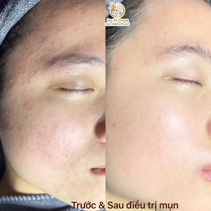 Ảnh Spa Bác Sỹ Nương 2