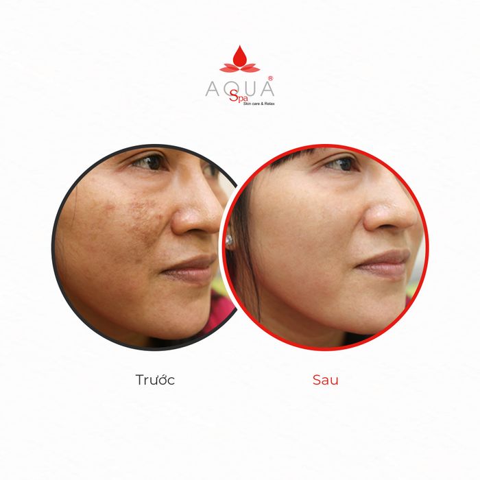 Ảnh của Aqua spa 2