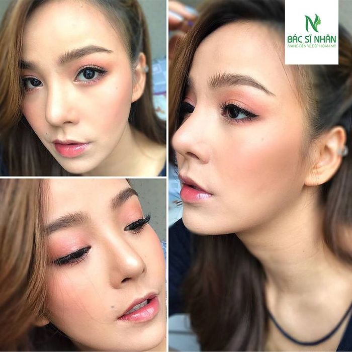 Thẩm Mỹ Viện Bác Sĩ Nhân hình ảnh 2