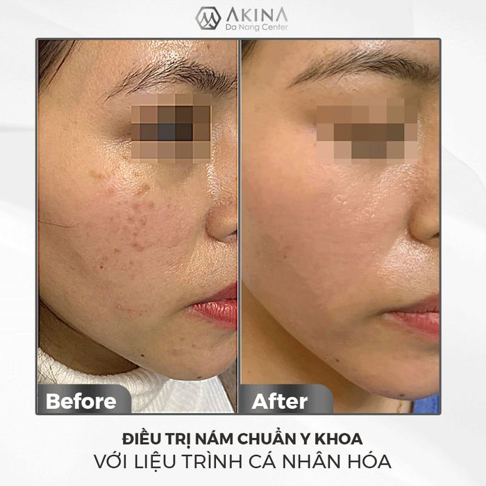 Hình ảnh 2 của AKINA Center Đà Nẵng - Bác sĩ Cao Nguyên