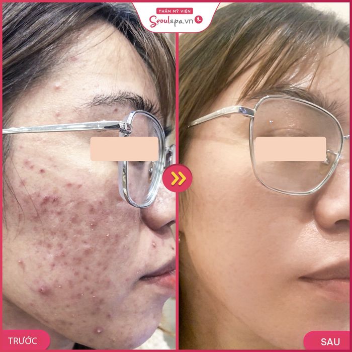 Ảnh Thẩm Mỹ Viện SeoulSpa.Vn Đà Lạt 2
