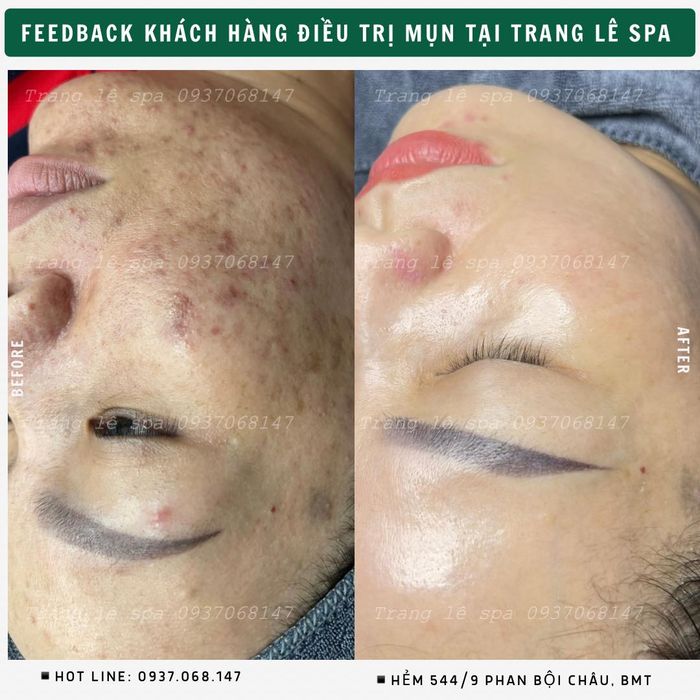 Hình ảnh 2 của Trang Lê Spa