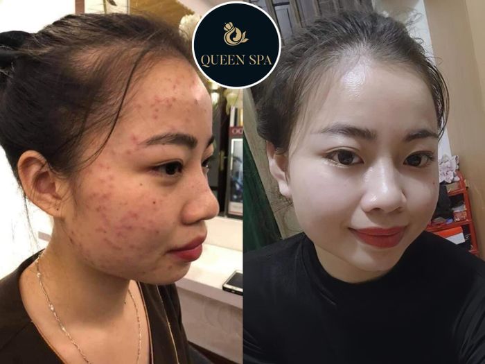 Hình ảnh 2 của Thẩm Mỹ Queen Spa