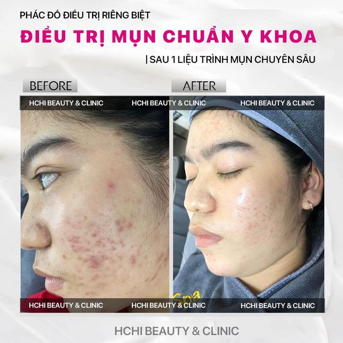 Hình ảnh 1 của HCHI Beauty Clinic