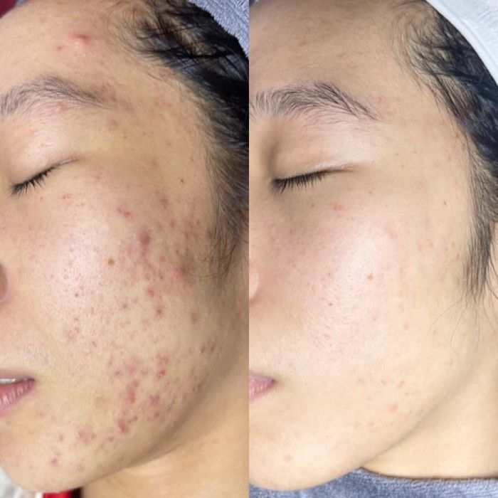 Hình ảnh 2 của Spa Bác sỹ Nương