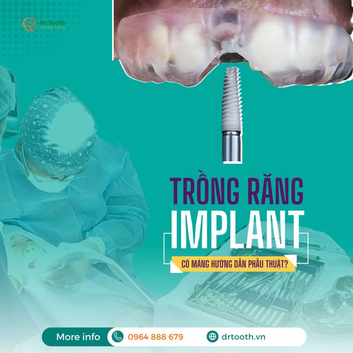 Hình ảnh 1 tại Nha Khoa Dr.Tooth