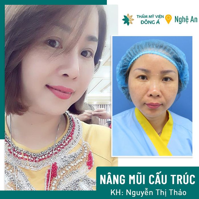 Hình ảnh Bệnh viện Thẩm mỹ Đông Á 1