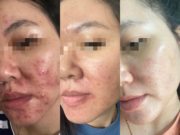 Ảnh 2 của Nina Phùng - Spa và Clinic