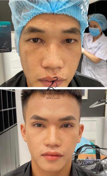 Hình ảnh Viện Thẩm Mỹ Phương Anh 2