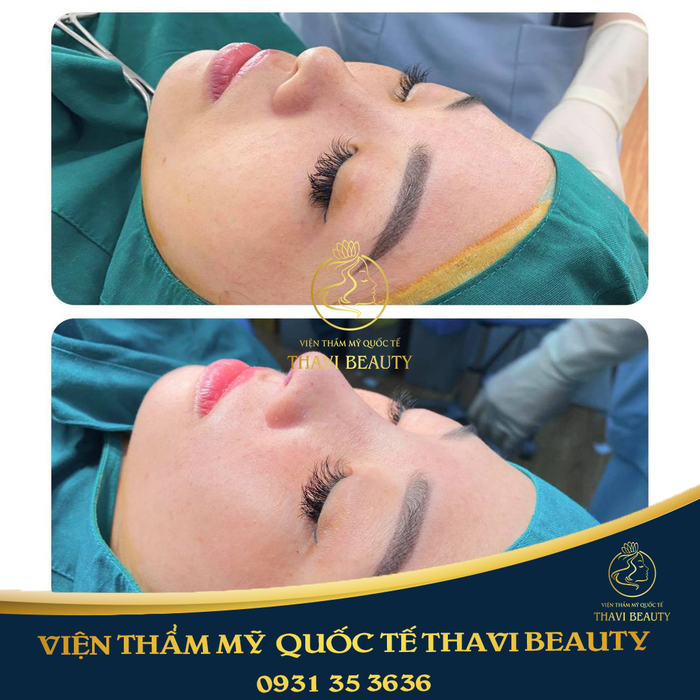 Hình ảnh Viện thẩm mỹ Quốc tế Thavi 1