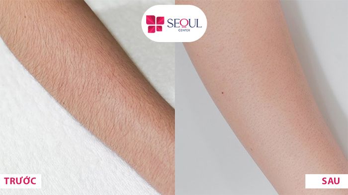 Hình ảnh Thẩm Mỹ Viện Seoul Center Biên Hoà 2