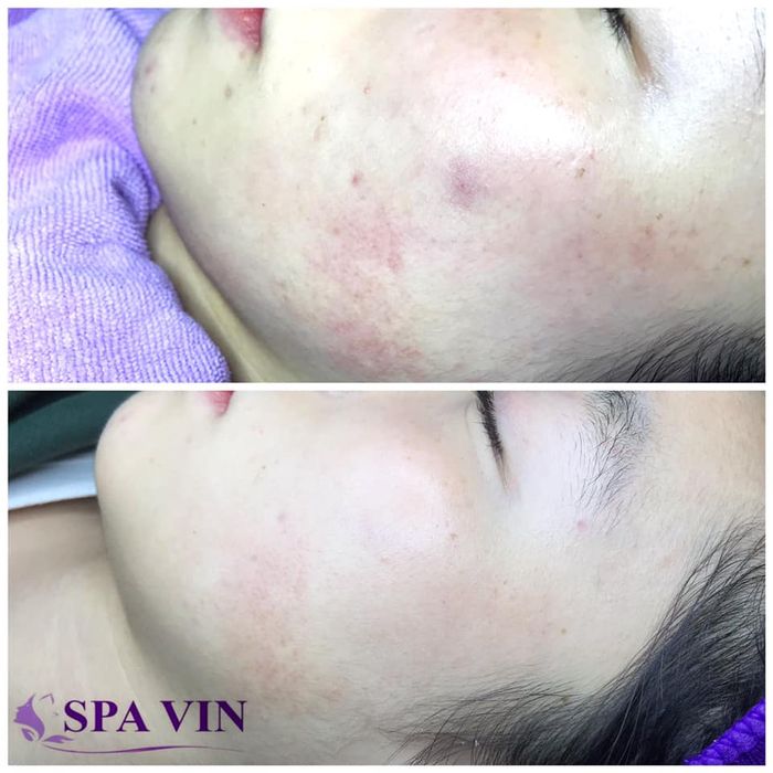 Ảnh 2 Spa Vin Đà Lạt