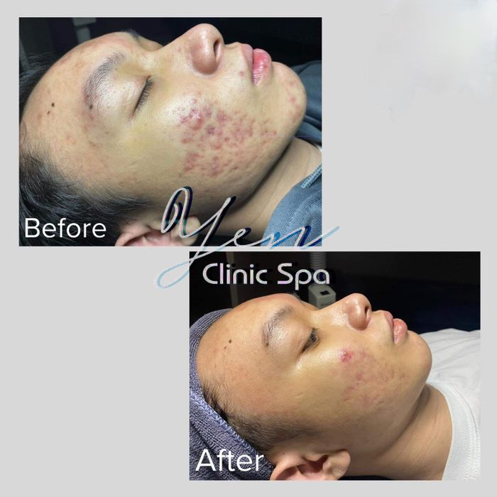 Hình ảnh Yên Clinic Spa 2