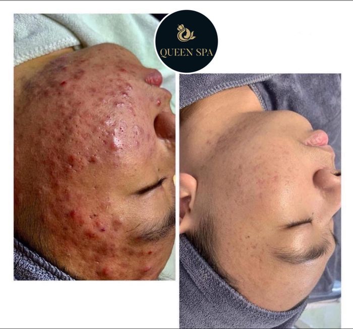 Hình ảnh 1 của Thẩm Mỹ Queen Spa