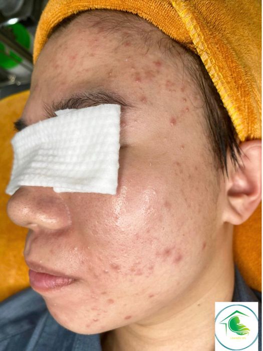 Hình ảnh Lâm Kiều Spa - Vũng Tàu 1