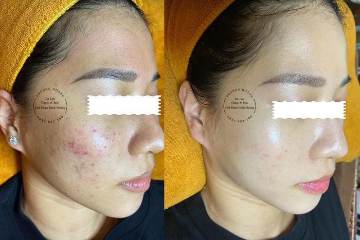 Ảnh 1 Phượng Hoàng Đà Lạt Clinic & Spa
