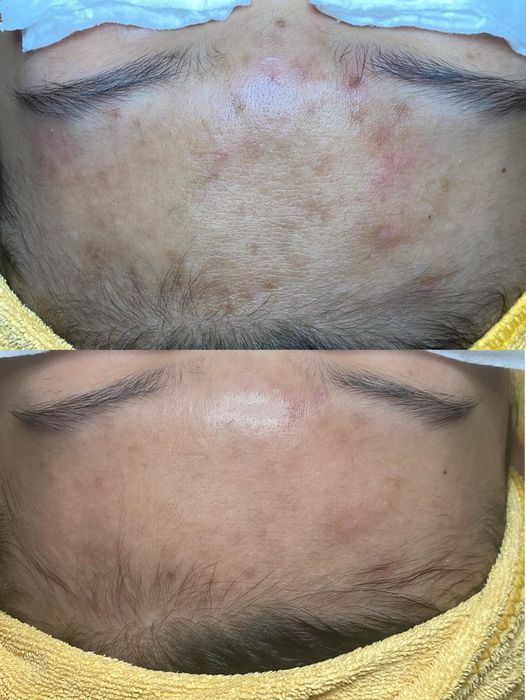 Ảnh của Nina Phùng - Spa và Clinic