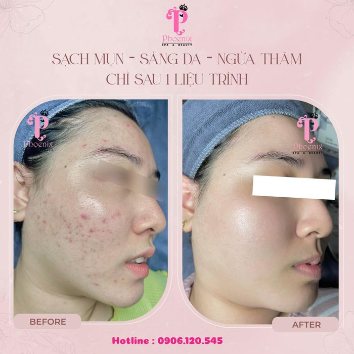 Phoenix Spa & Academy Đà Lạt hình 1