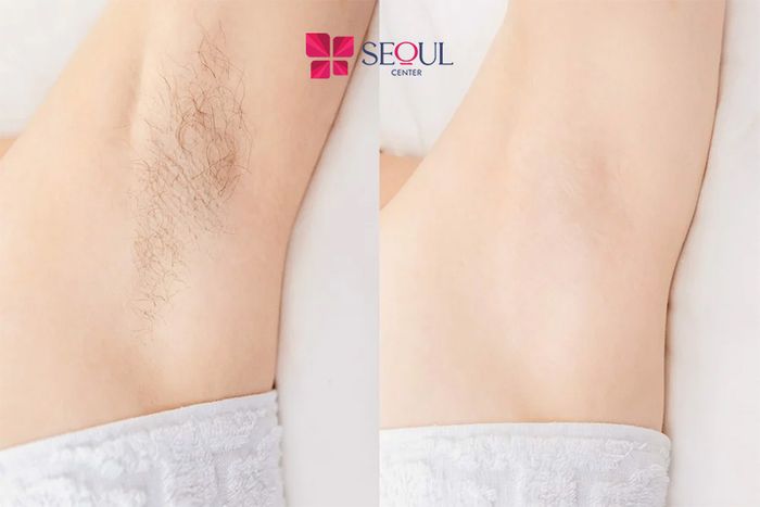 Hình ảnh Thẩm Mỹ Viện Seoul Center Biên Hoà 1