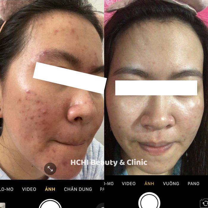 Hình ảnh 2 của HCHI Beauty Clinic