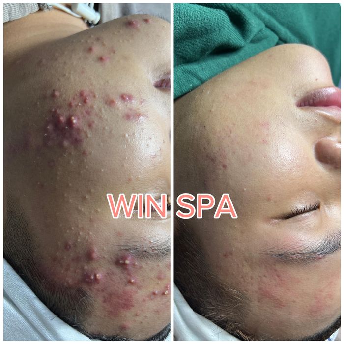 Hình ảnh WIN Spa 2