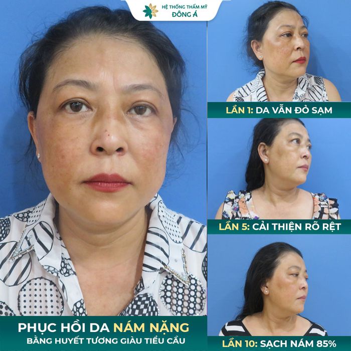 Bệnh viện thẩm mỹ Đông Á hình 2