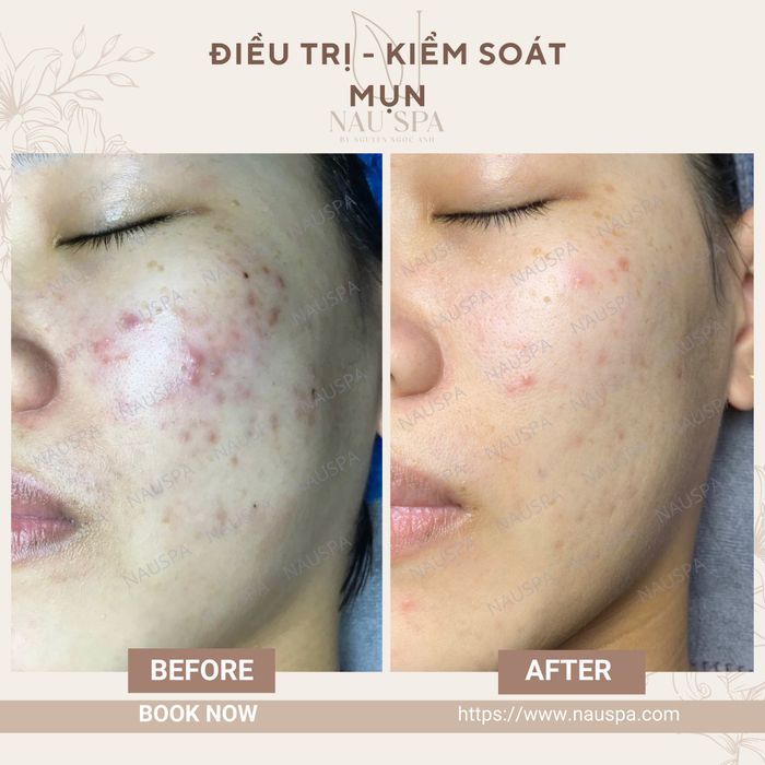 Hình ảnh Nâu Spa 1