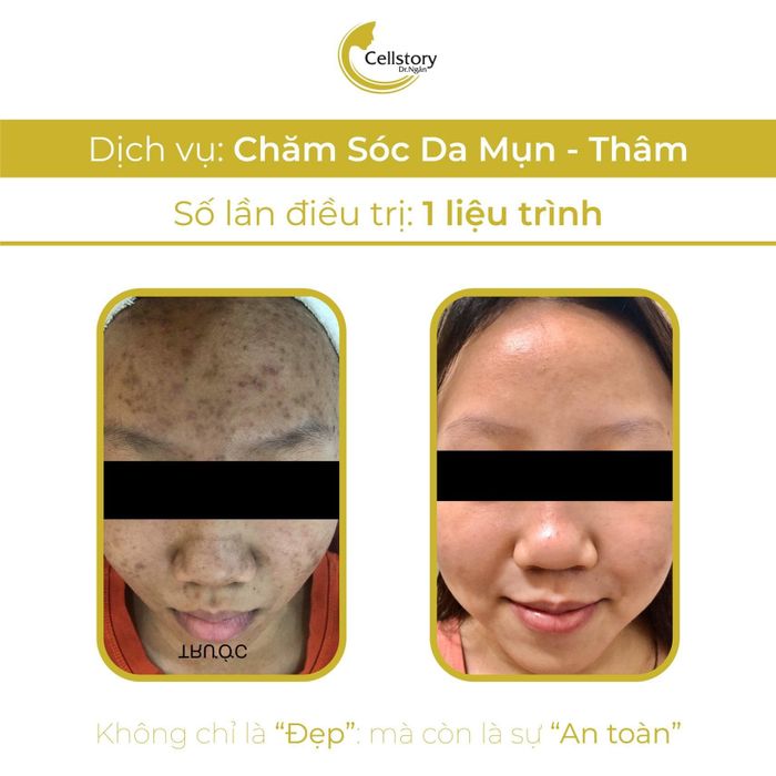 Cell Story Spa - Dr Đào Kim Ngân hình ảnh 2
