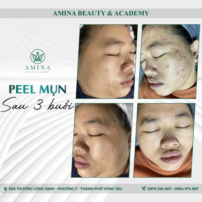 Hình ảnh Viện Thẩm Mỹ AMINA 1