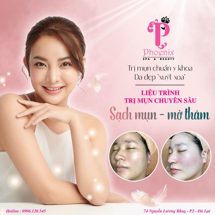 Phoenix Spa & Academy Đà Lạt hình 2