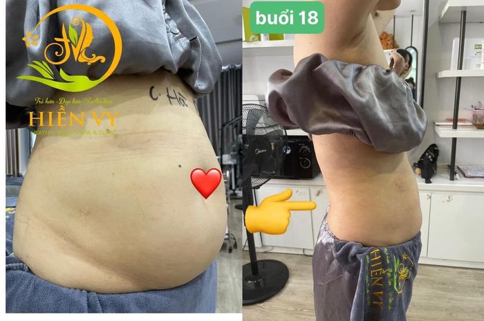Hình ảnh Thẩm Mỹ Viện Hiền Vy 1