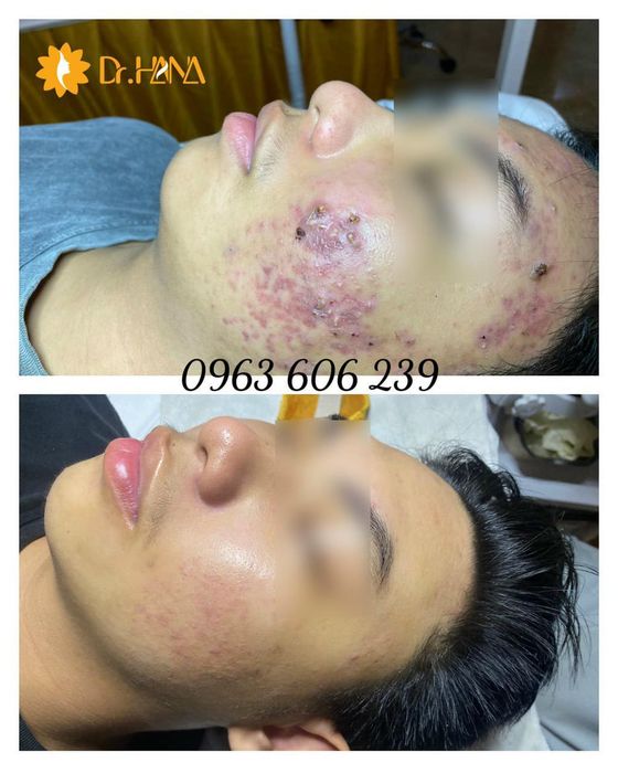 Hình ảnh Hana Spa Vũng Tàu 1