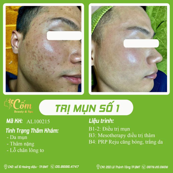 Hình ảnh 2 của Cốm Beauty & Spa