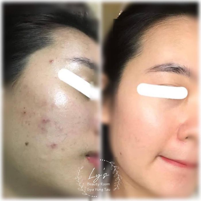 Hình ảnh Ly’s Beauty Room 2