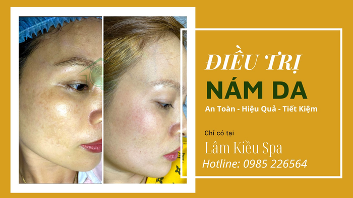 Hình ảnh 1 tại Lâm Kiều Spa