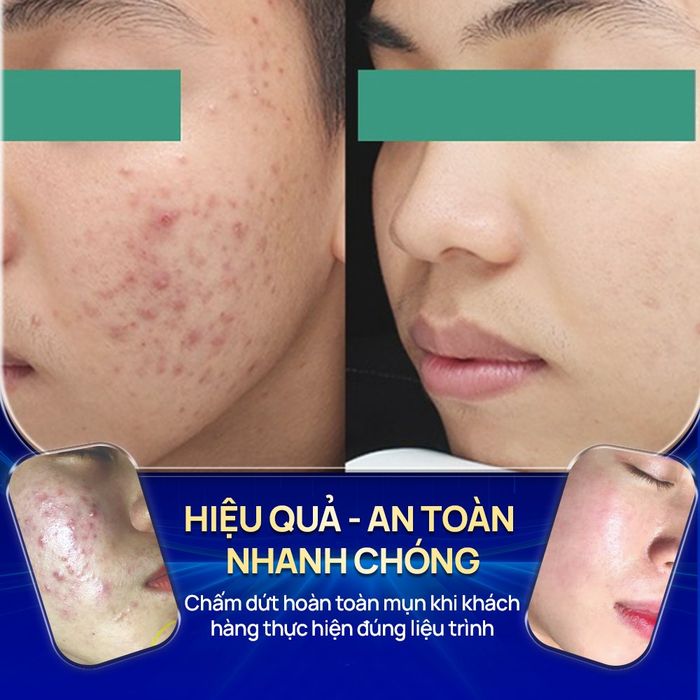 Hình ảnh 2 của Tấm Spa & Massage Trị Liệu