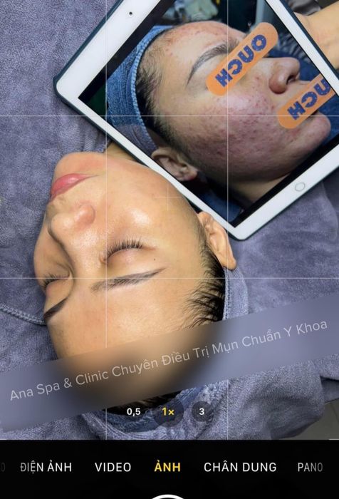 Hình ảnh 2 của Ana Spa & Clinic
