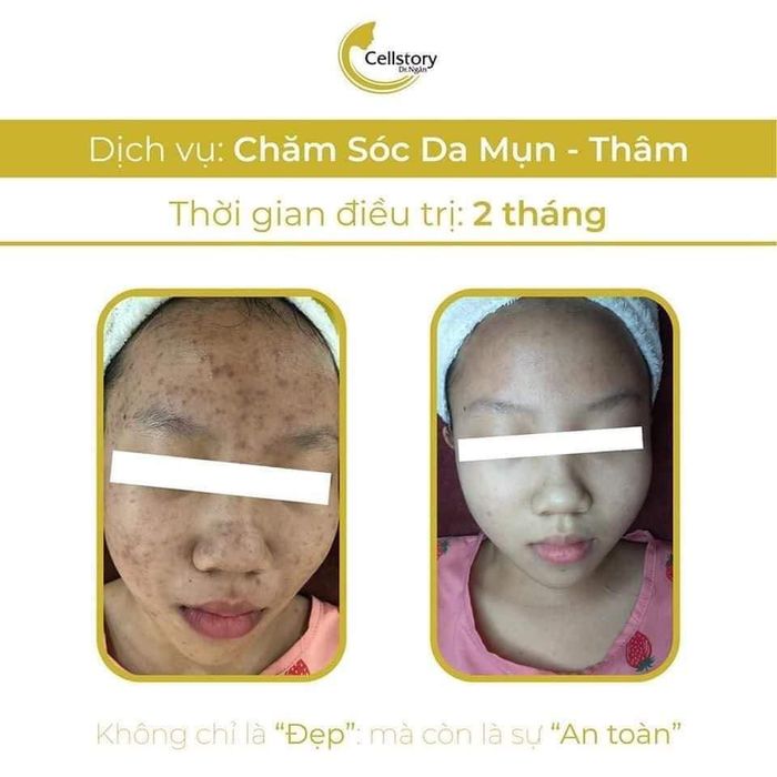 Ảnh 1 của Cell Story Spa - Dr Đào Kim Ngân