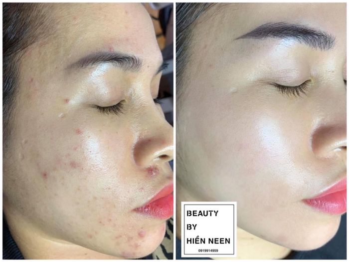 Ảnh 1 Hiền Neen Spa