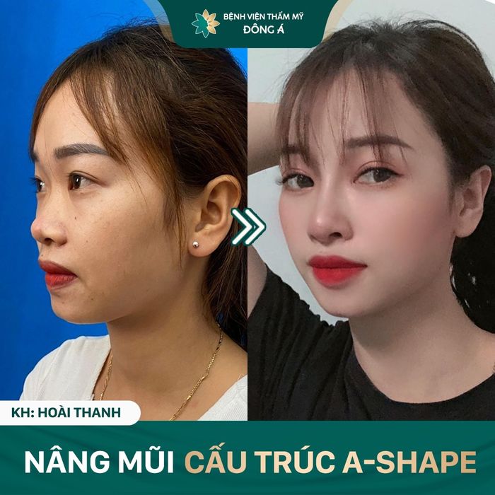 Hình ảnh Thẩm mỹ Đông Á 1