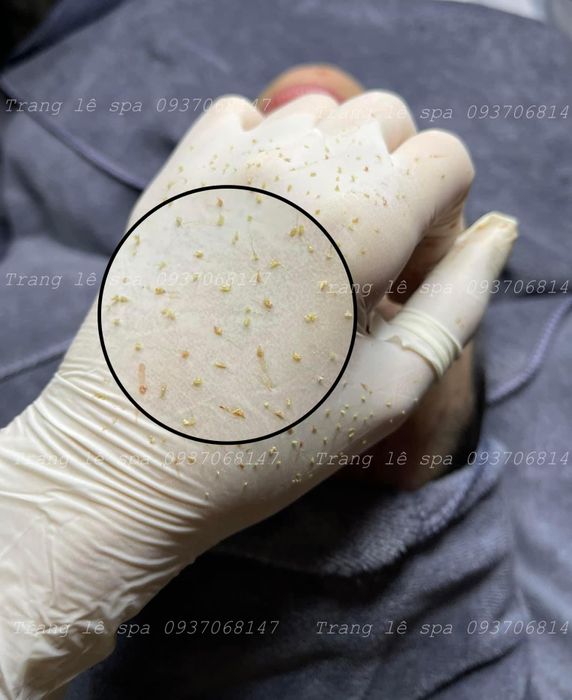Hình ảnh 1 của Trang Lê Spa