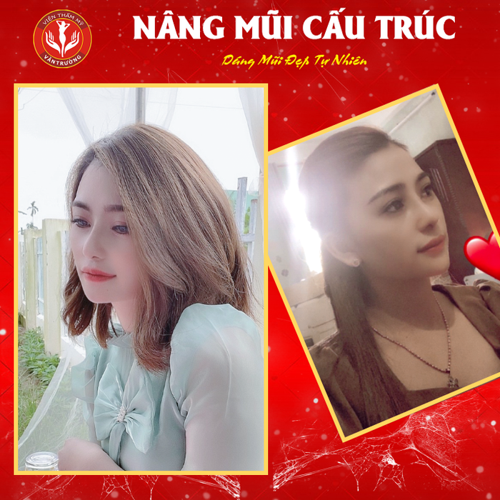 Hình ảnh Viện Thẩm Mỹ Văn Trường 1