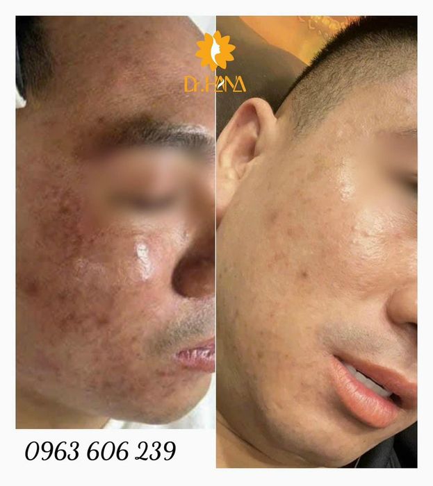 Hình ảnh Hana Spa Vũng Tàu 2