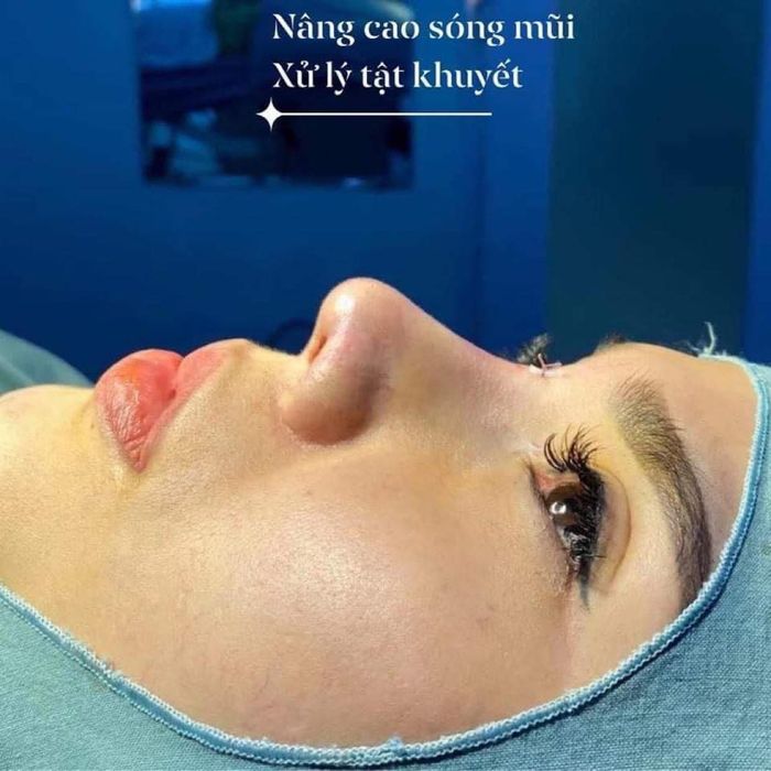 Hình ảnh Viện Thẩm Mỹ Linh Châu 2