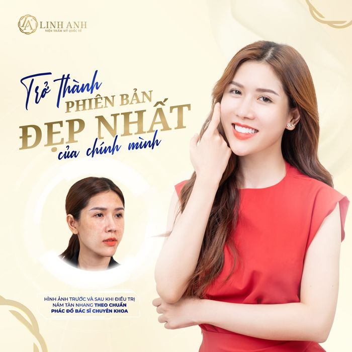 Thẩm mỹ quốc tế Linh Anh hình 2