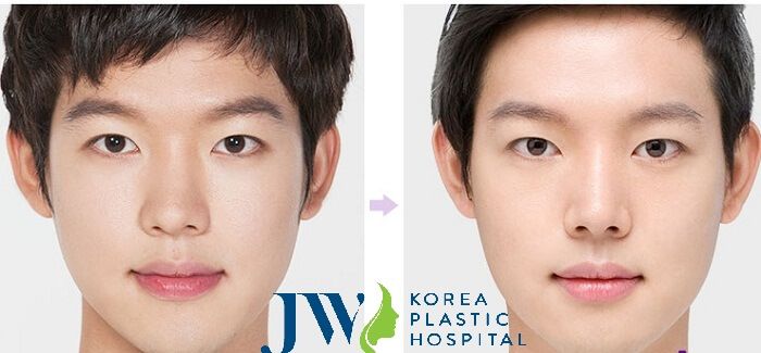 Hình ảnh Bệnh viện thẩm mỹ JW Hàn Quốc số 2