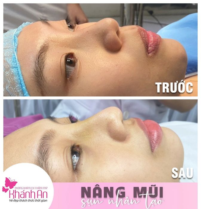 Hình ảnh Thẩm mỹ Khánh An 2