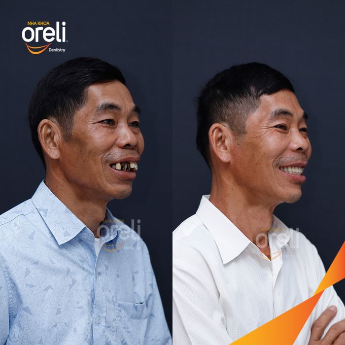 Hình ảnh 2 của Nha Khoa Oreli - Nụ Cười Hoàn Hảo