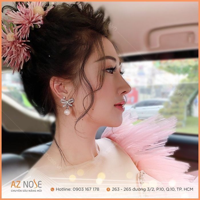 AZ NOSE - Phòng Khám Nâng Mũi - Hình 2